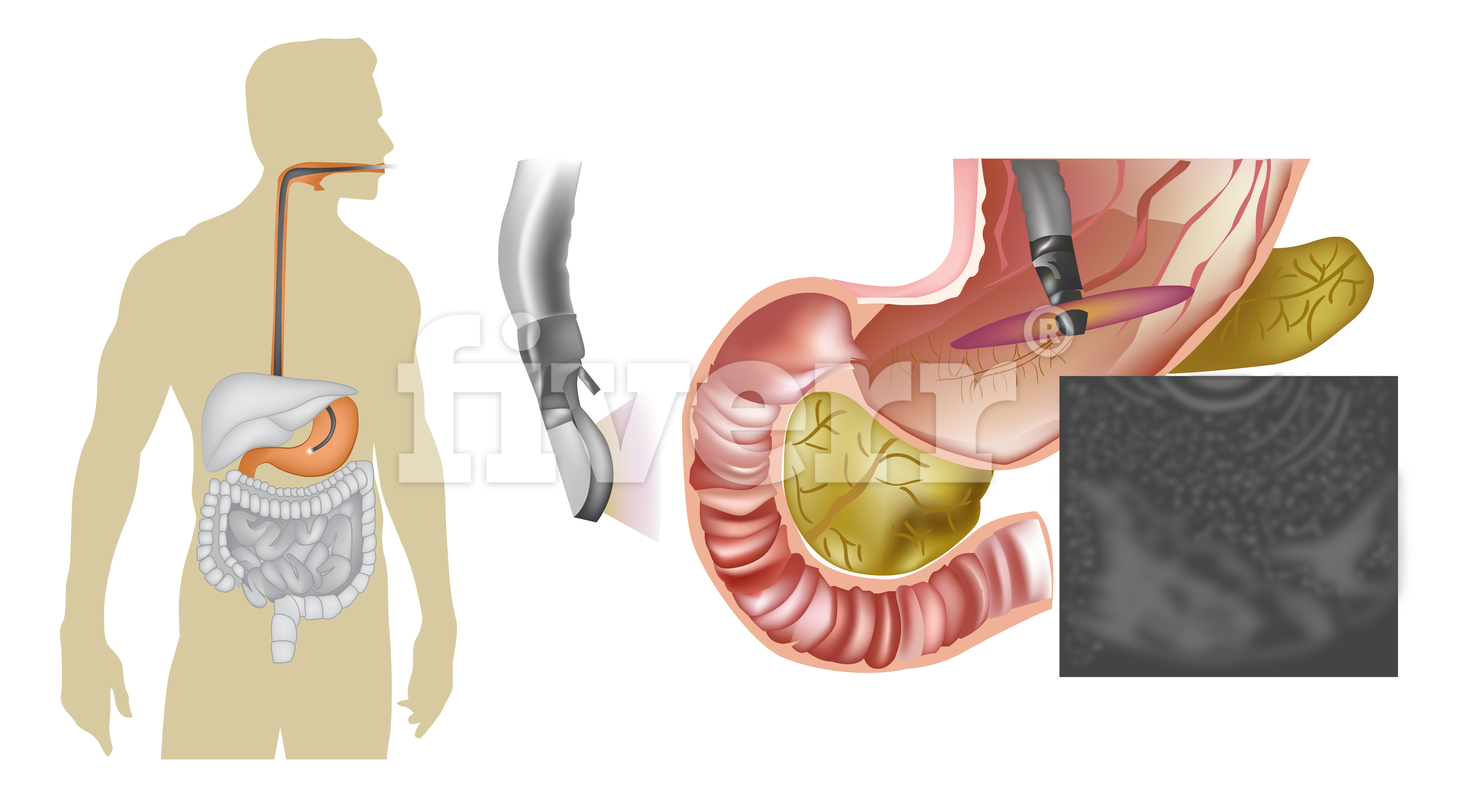 Gastroenterology consultants of augusta services