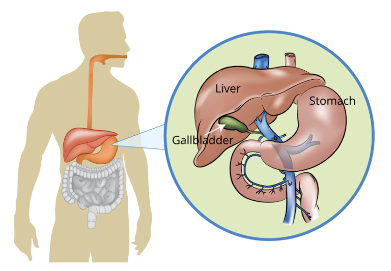 Liver, Pancreas and Gallbladder Conditions What Are They?