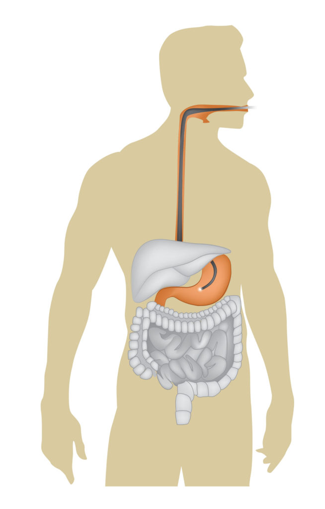 Endoscopy Biology Diagrams
